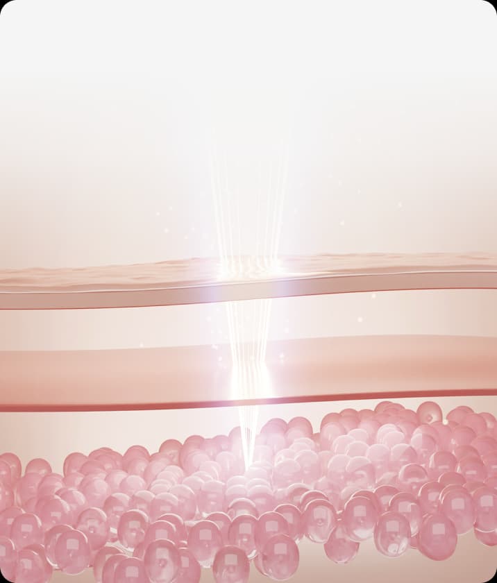 트리클 카드 배경