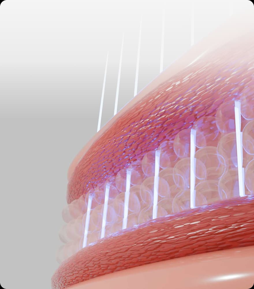 트리클 카드 배경