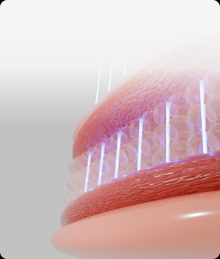 트리클 카드 배경