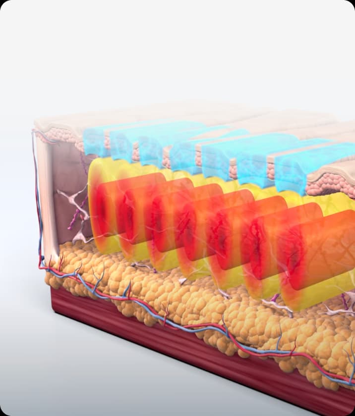 트리클 카드 배경