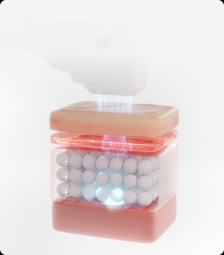 트리클 카드 배경