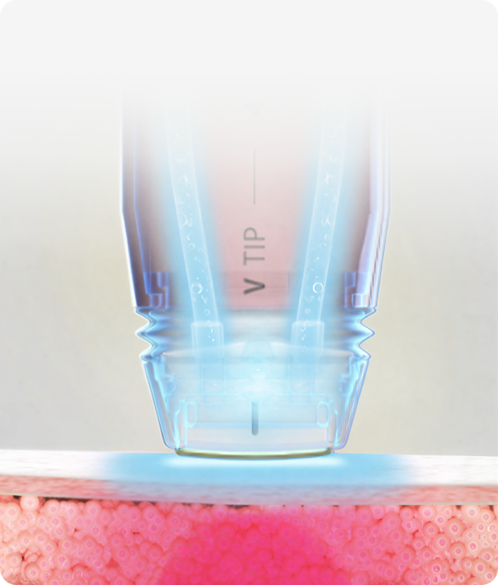 트리클 카드 배경